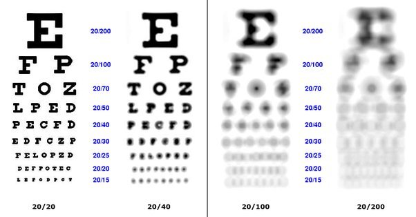 2010 vs 2020 Vision