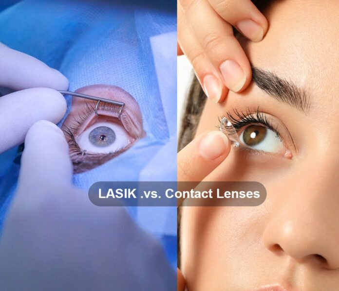 LASIK vs. Contact Lenses Contacts-vs-LASIK.webp
