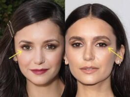 Celebrities with Ptosis: Famous Faces with Drooping Eyelids Celebrities with Ptosis Famous Faces with Drooping Eyelids